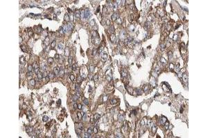 ABIN6266884 at 1/100 staining human stomach tissue sections by IHC-P.
