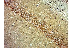 Paraformaldehyde-fixed, paraffin embedded mouse brain, Antigen retrieval by boiling in sodium citrate buffer (pH6) for 15min, Block endogenous peroxidase by 3% hydrogen peroxide for 30 minutes, Blocking buffer (normal goat serum) at 37°C for 20min, Antibody incubation with MAP3K13 Polyclonal Antibody  at 1:400 overnight at 4°C, followed by a conjugated secondary and DAB staining.