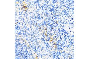 Immunohistochemistry of paraffin-embedded mouse spleen using CAMP antibody (ABIN3022305, ABIN3022306, ABIN3022307, ABIN1512664 and ABIN6218724) at dilution of 1:200 (40x lens).