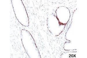 IHC staining of human prostate (20X) with HMW Cytokeratin antibody (34bE12). (KRT1 anticorps)