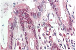 Rabbit Anti-RAD23B antibody Catalog Number: ARP56505 Formalin Fixed Paraffin Embedded Tissue: Human Adult Colon  Observed Staining: Cytoplasm in hepatocytes Primary Antibody Concentration: 1:600 Secondary Antibody: Donkey anti-Rabbit-Cy3 Secondary Antibody Concentration: 1:200 Magnification: 20X Exposure Time: 0. (RAD23B anticorps  (Middle Region))