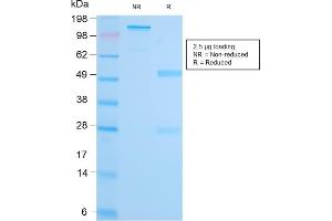 SDS-PAGE Analysis Purified MALT1 Recombinant Rabbit Monoclonal Antibody (MT1/3159R).