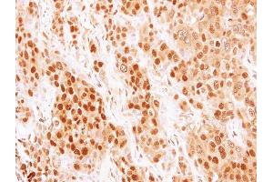 IHC-P Image Immunohistochemical analysis of paraffin-embedded BT474 xenograft, using COMMD7, antibody at 1:500 dilution.