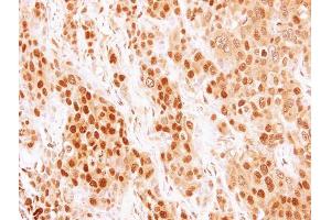 IHC-P Image Immunohistochemical analysis of paraffin-embedded BT474 xenograft, using COMMD7, antibody at 1:500 dilution. (COMMD7 anticorps)