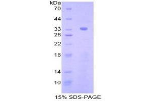 SDS-PAGE analysis of Mouse Nucleoredoxin Protein. (NXN Protéine)