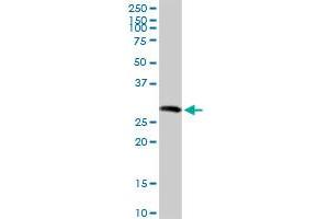 SGCG MaxPab rabbit polyclonal antibody. (SGCG anticorps  (AA 1-291))