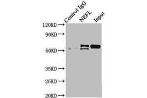 Immunoprecipitating NEFL in mouse brain tissue Lane 1: Rabbit control IgG instead of ABIN7161278 in mouse brain tissue. (NEFL anticorps  (AA 128-271))