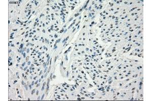 Immunohistochemical staining of paraffin-embedded endometrium tissue using anti-FCGR2A mouse monoclonal antibody. (FCGR2A anticorps)