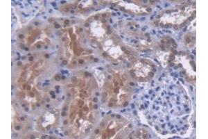 DAB staining on IHC-P; Samples: Human Kidney Tissue