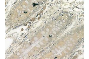 ABIN6261221 and ABIN6278110 at 1/100 staining human normal colon tissue by IHC-P. (DAP Kinase 1 anticorps  (Internal Region))