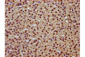 IHC image of ABIN7159037 diluted at 1:800 and staining in paraffin-embedded human adrenal gland tissue performed on a Leica BondTM system.