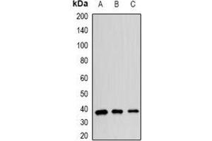 Western blot analysis of hnRNP E2 expression in SW620 (A), MCF7 (B), mouse spleen (C) whole cell lysates.