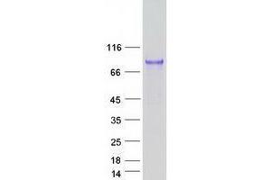 Validation with Western Blot