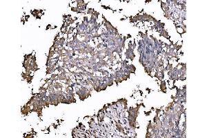 IHC analysis of FXR1 using anti-FXR1 antibody (ABIN7600093). (FXR1 anticorps  (AA 149-614))