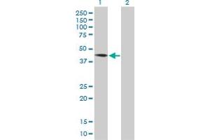 Western Blot analysis of DYX1C1 expression in transfected 293T cell line by DYX1C1 MaxPab polyclonal antibody. (DYX1C1 anticorps  (AA 1-381))