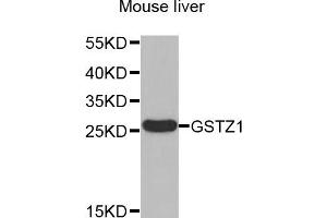 Western blot analysis of extracts of Mouse liver , using GSTZ1 antibody. (GSTZ1 anticorps)