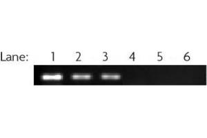 RbAp46/48 antibody (pAb) tested by ChIP ChIP performed on MCF7 cell chromatin (40 μg) using 39198. (RbAp46/48 anticorps)