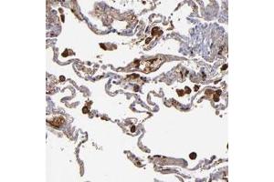 Immunohistochemical staining of human lung with C1QA polyclonal antibody  shows strong cytoplasmic positivity in macrophages. (C1QA anticorps)