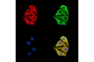 ABIN7095999 and ABIN7100061 staining Hela cells by IF/ICC. (SOSTDC1 anticorps)