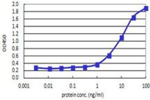 IL4R (Human) Matched Antibody Pair