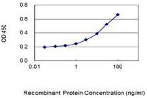 Detection limit for recombinant GST tagged SP1 is 0.
