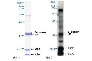 Kinase Activity Assay (KAA) image for Dual-Specificity tyrosine-(Y)-phosphorylation Regulated Kinase 2 (DYRK2) (AA 1-528) protein (GST tag) (ABIN1352206)