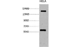 Western blot analysis of Hela, diluted at 1:2000.