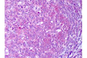 Anti-IL-13 antibody IHC of human tonsil, germinal center.