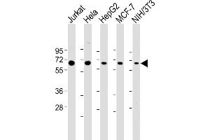 All lanes : Anti-PSMD3 Antibody (C-Term) at 1:2000 dilution Lane 1: Jurkat whole cell lysate Lane 2: Hela whole cell lysate Lane 3: HepG2 whole cell lysate Lane 4: MCF-7 whole cell lysate Lane 5: NIH/3T3 whole cell lysate Lysates/proteins at 20 μg per lane. (PSMD3 anticorps  (AA 482-515))