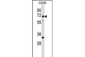 NPLOC4 Antibody (C-term) (ABIN1537359 and ABIN2848982) western blot analysis in CEM cell line lysates (35 μg/lane). (NPLOC4 anticorps  (C-Term))