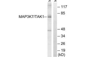 Western Blotting (WB) image for anti-Mitogen-Activated Protein Kinase Kinase Kinase 7 (MAP3K7) (Thr187) antibody (ABIN1848228)