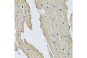 Immunohistochemistry of paraffin-embedded mouse heart using PRPH antibody (ABIN5972212) at dilution of 1/100 (40x lens). (Peripherin anticorps)