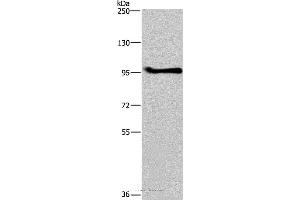 Western blot analysis of A549 cell, using LLGL1 Polyclonal Antibody at dilution of 1:350 (LLGL1 anticorps)