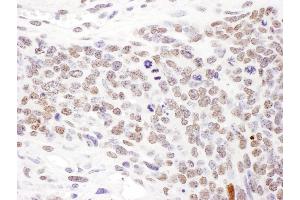 Immunohistochemistry (IHC) image for anti-Structural Maintenance of Chromosomes 1A (SMC1A) (pSer957) antibody (ABIN7453448) (SMC1A anticorps  (pSer957))