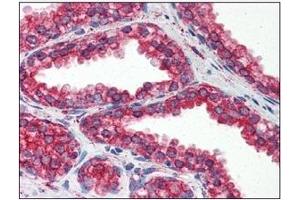 Immunohistochemistry (IHC) image for anti-Heat Shock Protein 90kDa beta (Grp94), Member 1 (HSP90B1) (AA 676-803) antibody (ABIN317570)