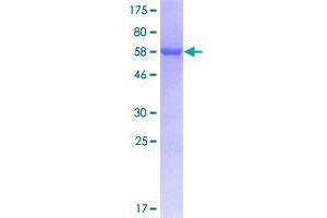 Image no. 1 for GIPC PDZ Domain Containing Family, Member 2 (GIPC2) (AA 1-315) protein (GST tag) (ABIN1355119)