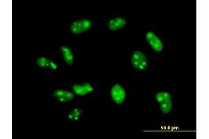Immunofluorescence of purified MaxPab antibody to EXOSC7 on HeLa cell. (EXOSC7 anticorps  (AA 1-291))