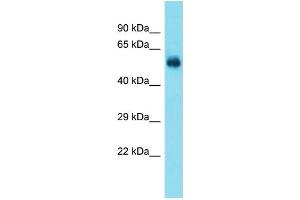 Host:  Rabbit  Target Name:  Taf1a  Sample Type:  Rat Brain lysates  Antibody Dilution:  1. (TAF1A anticorps  (N-Term))