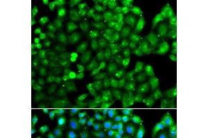 Immunofluorescence analysis of A549 cells using HLA-DRB1 Polyclonal Antibody (HLA-DRB1 anticorps)
