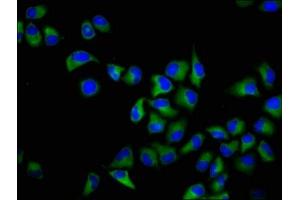 Immunofluorescence staining of Hela cells with ABIN7157174 at 1:166, counter-stained with DAPI.