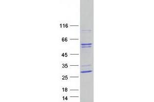 Validation with Western Blot