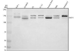 Western blot analysis of SYCP1 using anti-SYCP1 antibody (ABIN7825900).