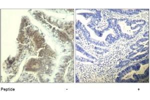 Image no. 1 for anti-Cyclin-Dependent Kinase 6 (CDK6) (Tyr13) antibody (ABIN319411)