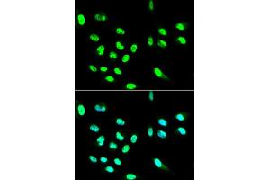 Immunofluorescence analysis of HepG2 cell using FCGR2A antibody. (FCGR2A anticorps)