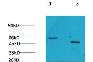 Western Blot (WB) analysis of 1) Rat Brain Tissue, 2)Mouse Brain Tissue with GLP1R Rabbit Polyclonal Antibody diluted at 1:2000. (GLP1R anticorps)