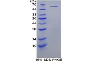 SDS-PAGE analysis of Mouse MYC Protein.