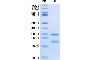 Human MASP2 on Tris-Bis PAGE under reduced condition. (MASP2 Protein (AA 288-686) (His tag))