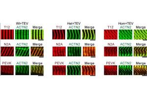 Immunofluorescence (IF) micrographs of skeletal fibers labeled with different antibodies to I-band titin (T12, N2A, and PEVK, red IF staining), and Z-disk marker α-actinin (ACTN2, green IF staining).