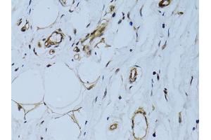 Immunohistochemistry of paraffin-embedded human breast using MCAM antibody (ABIN6290150) at dilution of 1:100 (40x lens). (MCAM anticorps)