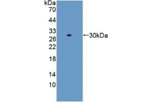 Detection of Recombinant LACTb, Human using Polyclonal Antibody to Lactamase Beta (LACTb)